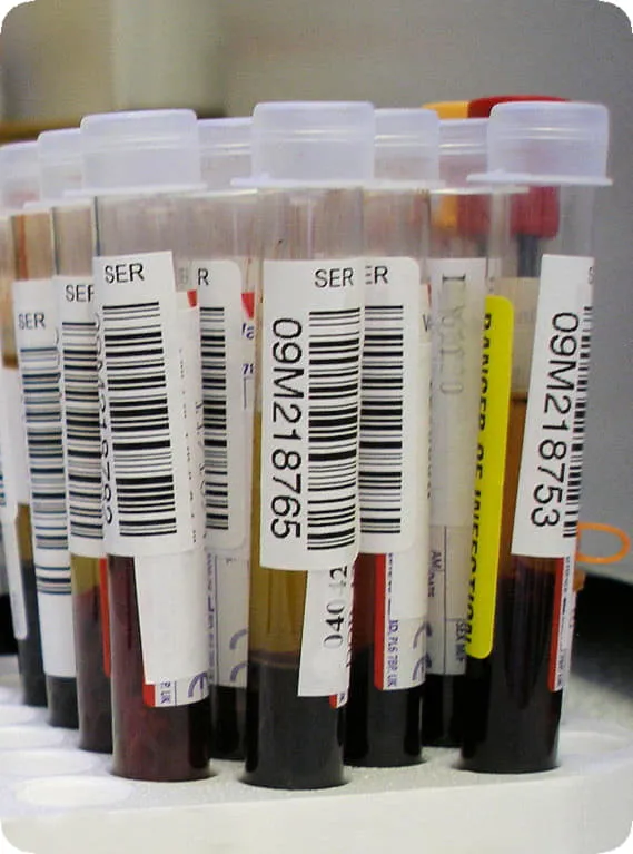 Blood Samples Stored at Labitus